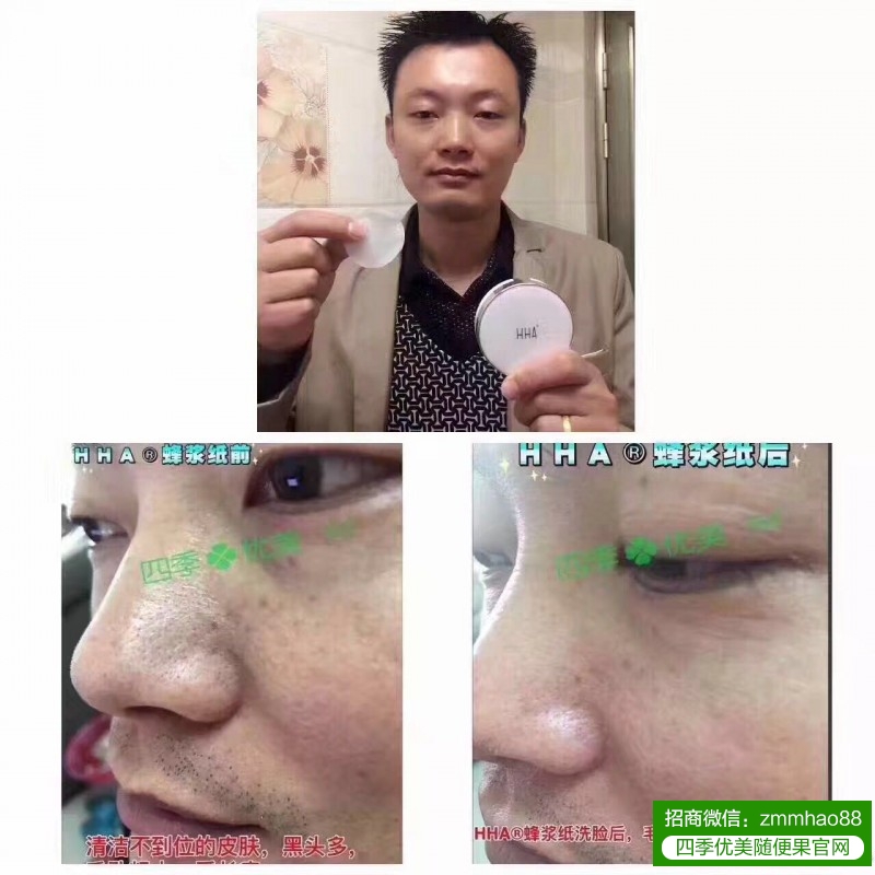 祛黑头，HHA蜂浆纸的效果怎么样
