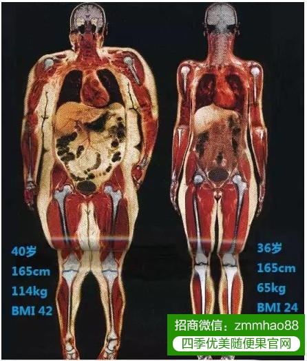 体重一样，为何你显胖？？？看完吓一跳